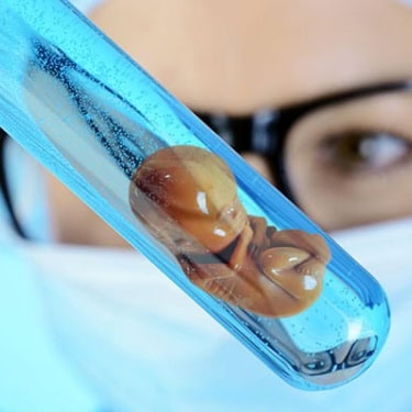 IUI –Intrauterine Insemination or Artificial Insemination (AI)